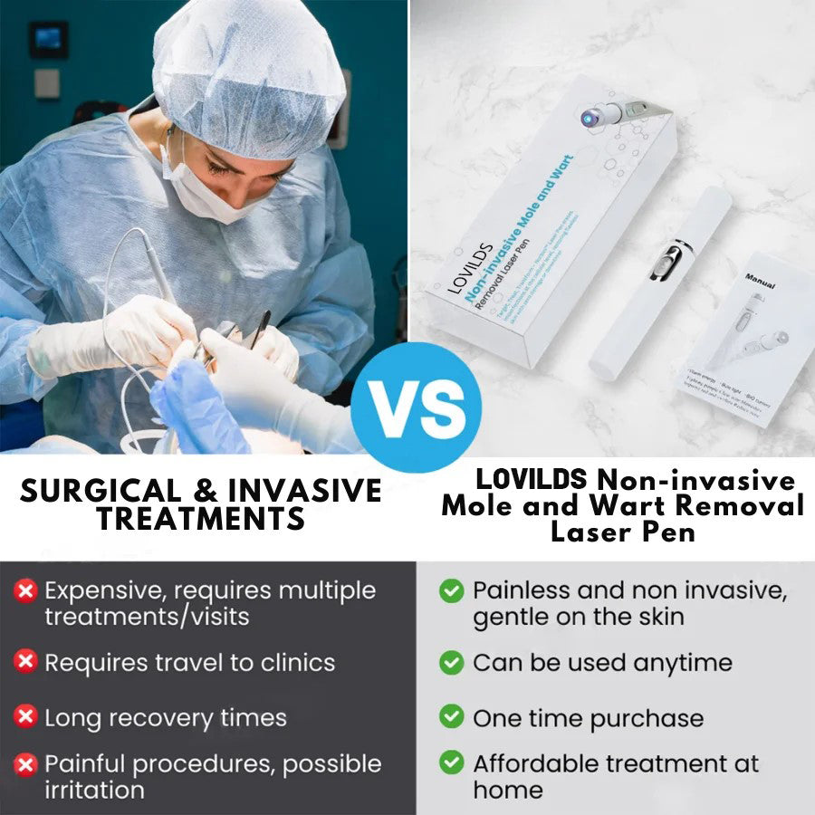 Buying Bazaar™ Non-Invasive Mole & Wart Removal Laser Pen – Safe, Painless, Portable